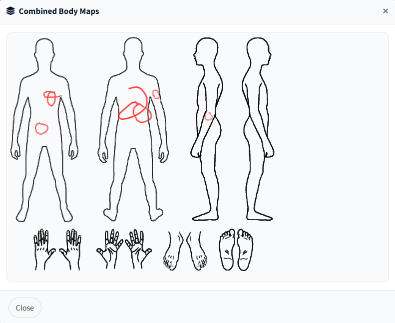 combined body map
